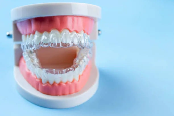 Can Retainers Fix Your Overbite? Exploring the Options - NewSmile UK