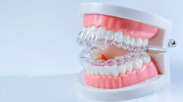 Retainers for Correcting Crossbites: Efficacy and Considerations ...