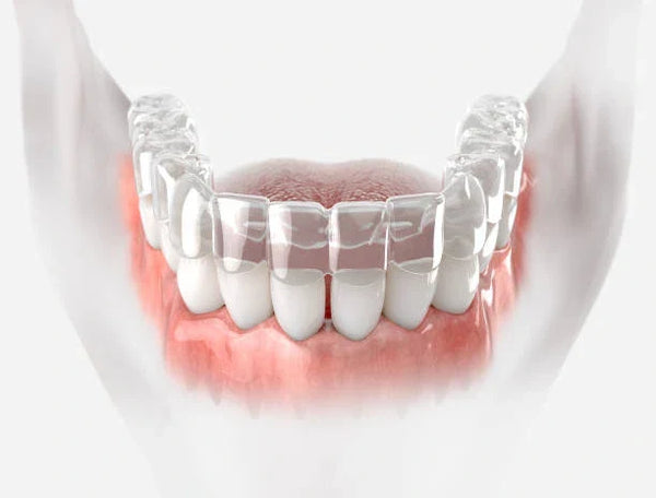 😁 Gap Teeth: Can Retainers Close Them? - NewSmile UK